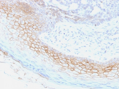 FFPE human skin sections stained with 100 ul anti-Desmocollin-2/3 (clone 7G6) at 1:400. HIER epitope retrieval prior to staining was performed in 10mM Tris 1mM EDTA, pH 9.0.